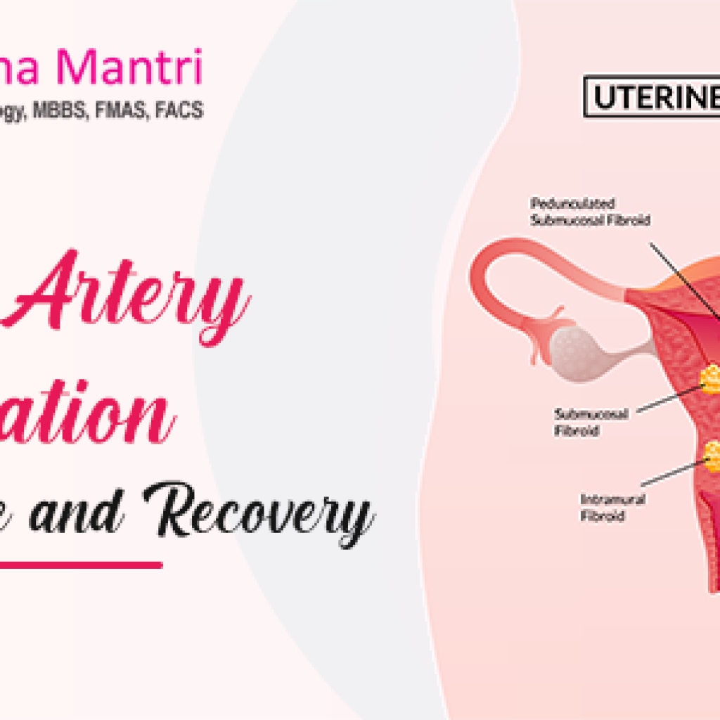 Uterine Artery Embolization Procedure And Recovery Dr Neelima Mantri Dr Neelima Mantri
