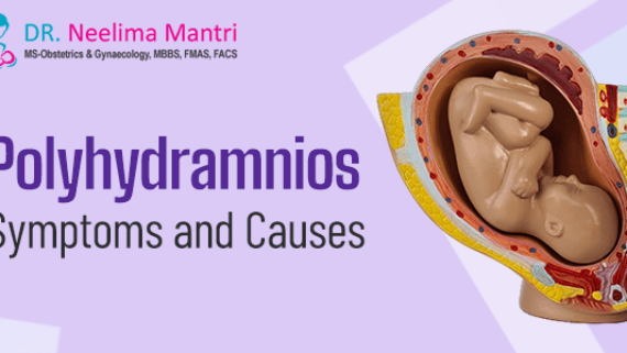 Polyhydramnios – Symptoms and Causes
