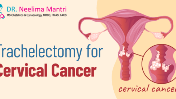 Trachelectomy for Cervical Cancer