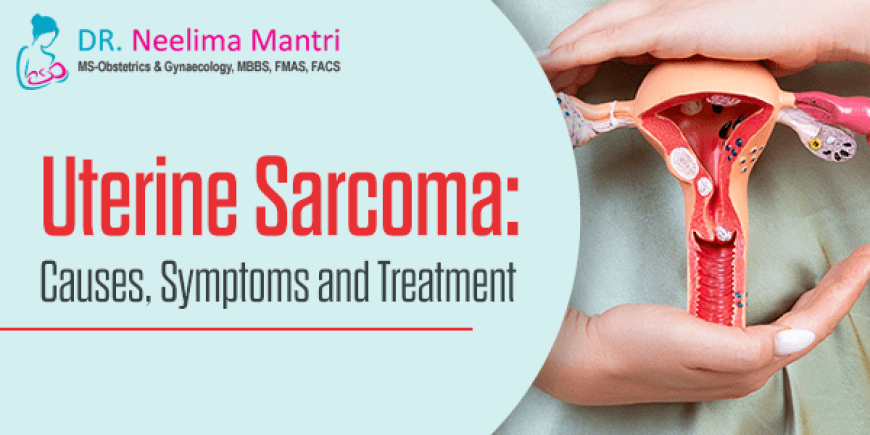Uterine Sarcoma: Causes, Symptoms and Treatment
